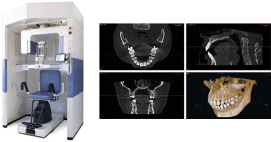 歯科用CT
