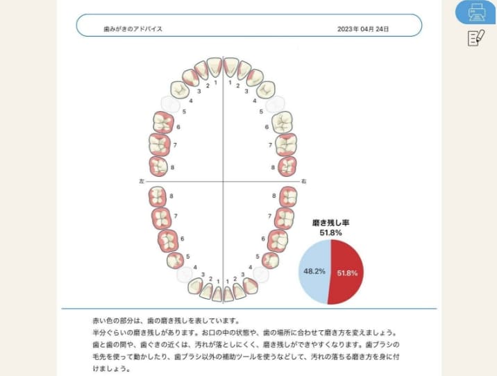 ③歯磨きのアドバイス